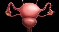 Global Polycystic Ovarian Syndrome Treatment Market